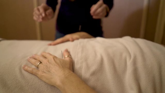 Detail of a professional acupuncturist inserting a needle into the hand of a mature caucasian woman at a spa for treatment.