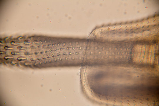  Infection by parasitic of Thorny-head worm in fish for education in laboratory.