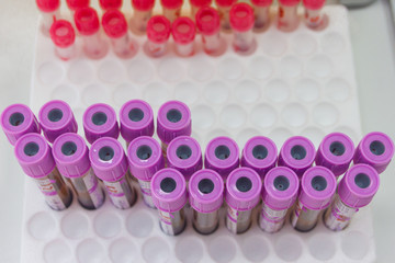test tubes with assays. Blood test. Laboratory.