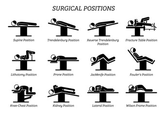 Surgical Surgery Operation Positions. Stick figures depict a set of surgery positions for the patient on the surgery chair and bed. - obrazy, fototapety, plakaty