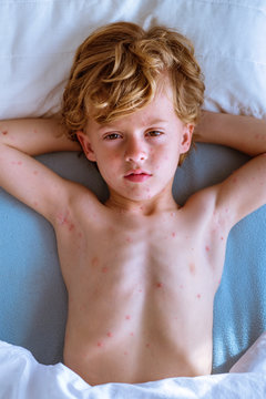 Sick little kid in bed
