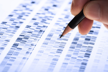 Wissenschaftler untersucht DNA-Gel - 195001585