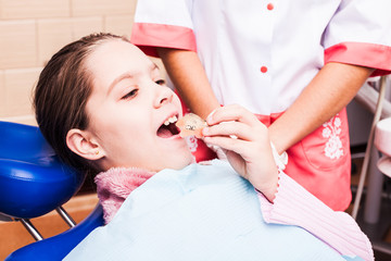 Methods of Teeth Bite Correction