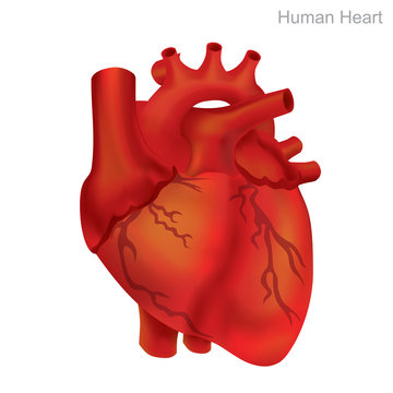 Human Heart Isolate. Angioplasty is an endovascular procedure to widen narrowed or obstructed arteries or veins, typically to treat arterial atherosclerosis