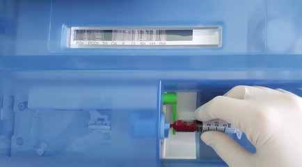 Arterial blood gas test measures the acidity and the levels of oxygen and carbon dioxide in the...