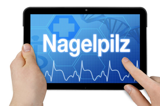 Tablet mit Diagnose Nagelpilz