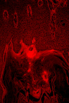 ill human skin
