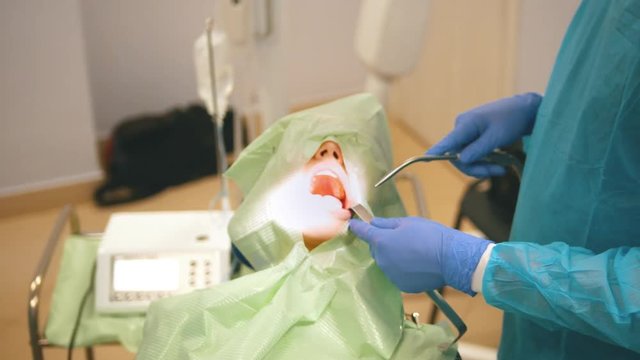 Dentist using surgical pliers to remove a decaying tooth in stomatology room