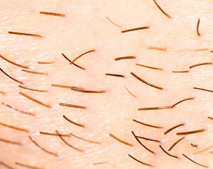 Bristles on the beard of a man