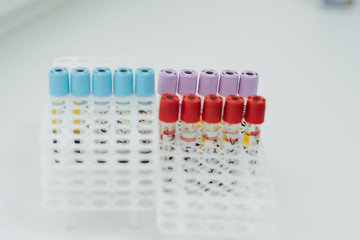 Medical equipment. Test tubes of centrifuge machine with blood and plasma in hematology laboratory....