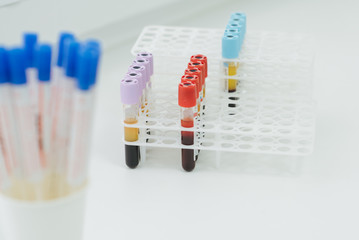 Medical equipment. Close up of some 3 ml test tubes with mauve plugs for blood samples on a rack. They are made of clear plastic and keeping EDTA anticoagulant.