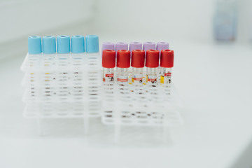 Medical equipment. Close up of some 3 ml test tubes with mauve plugs for blood samples on a rack. They are made of clear plastic and keeping EDTA anticoagulant.