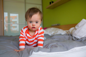 Portrait of cute baby boy with Down syndrome on the bed in home bedroom