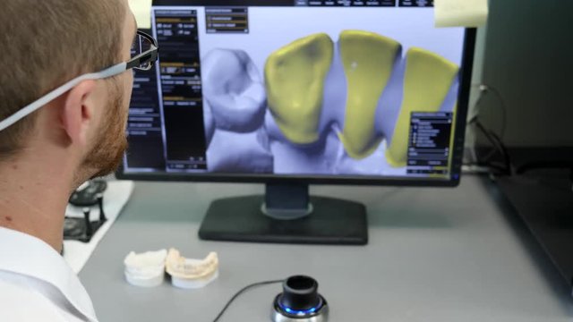 orthodontics laboratory for modeling and production dental implants for customers, young professional working at computer