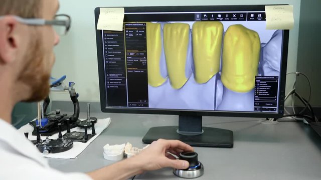 3D dental digital modeling, technician in eyeglasses works in special program and looks at image of human teeth on monitor close-up