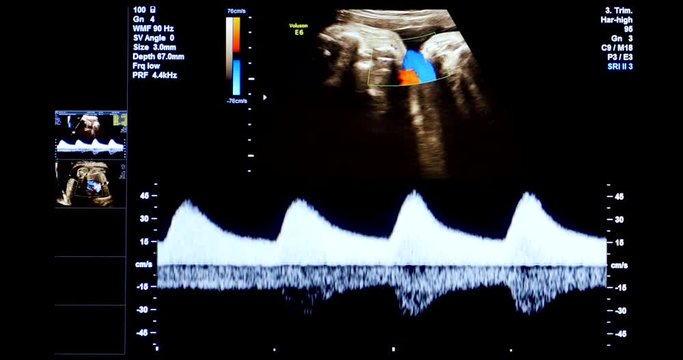 4K - Medical ultrasound scanning. heart rate diagnostics