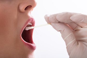 Dentist Taking Saliva Test Of A Patient - obrazy, fototapety, plakaty