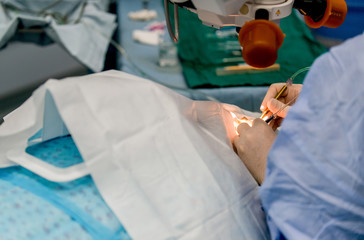 Doctors are in the process of conducting surgical operations on the eye. Closeup. medical concept