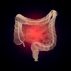 3D human organ Medicine concept with line. Human digestive system intestines gut anatomy gastrointestinal tract diagram. Meteorism, Enteritis, Colitis, Ulcerative Colitis, Dysbacteriosis, Diarrhea. - 195654731