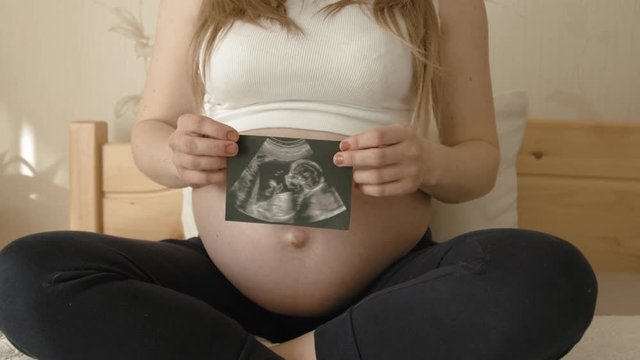 Pregnant girl holding ultrasound scan near her bare belly