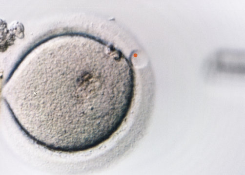 Closeup of Human Egg on Computer Screen