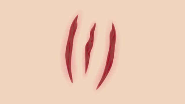human scabs and wound graphic animation