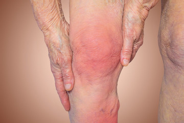 Senior woman holding the knee with pain