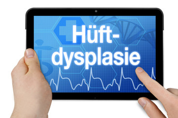 Tablet mit Diagnose Hüftdysplasie