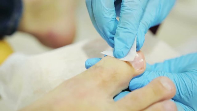 hands of the physician of the podologist make cleaning with a napkin of a nail of the man of the patient in beauty salon, close-up