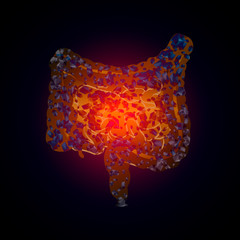 Naklejka premium Heaviness in the intestines. Colitis. Medical illustration of intestinal diseases