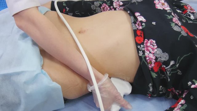 Ultrasound analysis in a Hospital