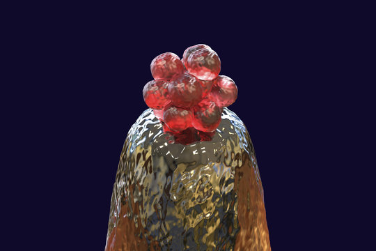 16-cell human embryo on a needle tip, 3D illustration