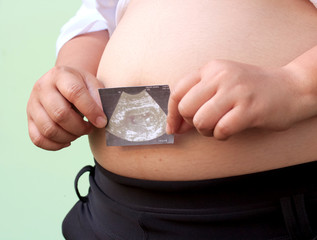 Close up of pregnant belly and holding ultrasound image. Concept of pregnancy, health care, gynecology, medicine.
