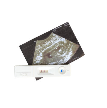 ultrasound with pregnancy test on white background