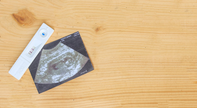 ultrasound with pregnancy test