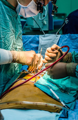 The surgeon's assistant helps to keep a suction during a cardiac operation.
