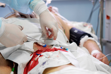 intensive care doctor anesthetist catheterising femoral artery, hands close up