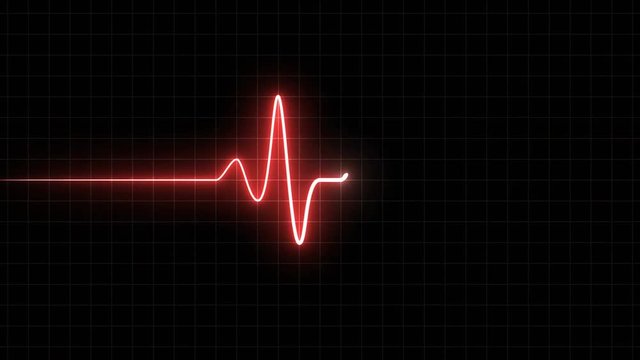 EKG 60 BPM Loop Screen, Red w/ Grid. Heart rate monitor / electrocardiogram (EKG or ECG) loop beeping at 60 beats per minute for screen savers or computer monitor displays, animated at 60fps.