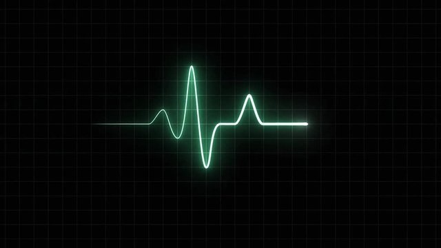 EKG 120 BPM Loop Screen, Green w/ Grid. Heart rate monitor / electrocardiogram (EKG or ECG) loop beeping at 120 beats per minute for screen savers or computer monitor displays, animated at 60fps.