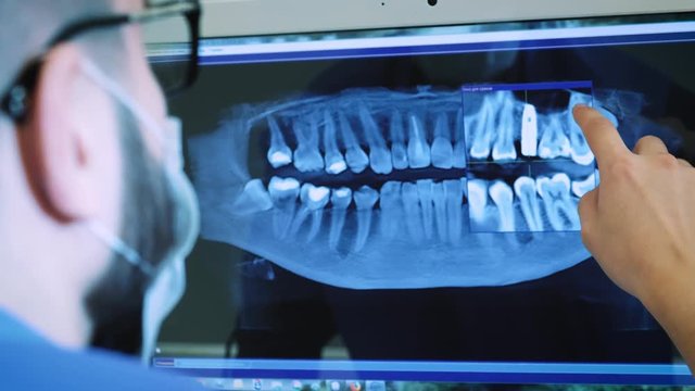 the dentist is studying the x-ray 3D image of the jaw.