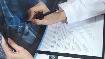 The doctor works in a modern private hospital. He looks at the x-ray of the patient in the medical office. - Powered by Adobe