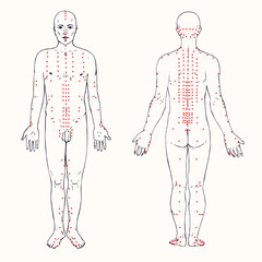 Body set (front and back) acupuncture scheme with red points, hand drawn doodle, sketch in pop art style, black and white medical vector illustration - 196467110