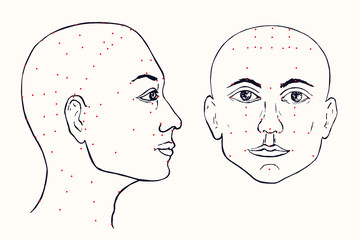 Face set (profile and front) acupuncture scheme with red points, hand drawn doodle, sketch in pop art style, black and white medical vector illustration