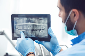 Intelligent dentist showing teeth x-ray on tablet, well-built man in green mask and blue gloves explaining particular case, sitting before dental chair in light huge office