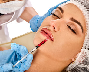 Filler injection for female forehead face. Plastic aesthetic facial surgery in beauty clinic. Doctor in medical gloves with syringe injects lips augmentation. Bottox injections.
