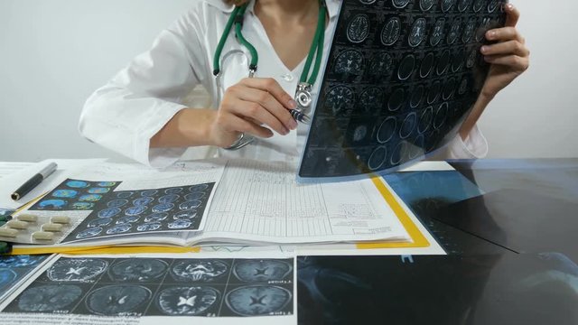 Female doctor is studying x-rays
