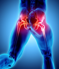 Hip painful skeleton x-ray, 3D illustration.