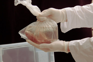 Kidney in solution in a package. men's hands in medical latex gloves gently hold the package with...