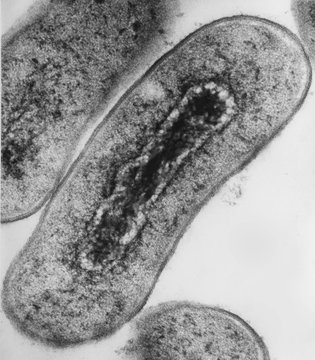 Cross section of Escherichia coli bacteria under transmission electron microscopy