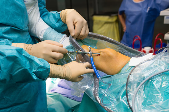 LIGAMENT SURGERY